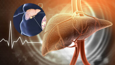 Fatty Liver को न करें नजरअंदाज! बढ़ सकता है हार्ट अटैक का खतरा, दिखें ये लक्षण तो तुरंत जाएं डॉक्टर के पास Fatty Liver को न करें नजरअंदाज! बढ़ सकता है हार्ट अटैक का खतरा, दिखें ये लक्षण तो तुरंत जाएं डॉक्टर के पास