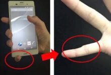 स्मार्टफोन पिंकी क्या है? ज्यादा फोन इस्तेमाल से उंगली पर पड़ सकता असर