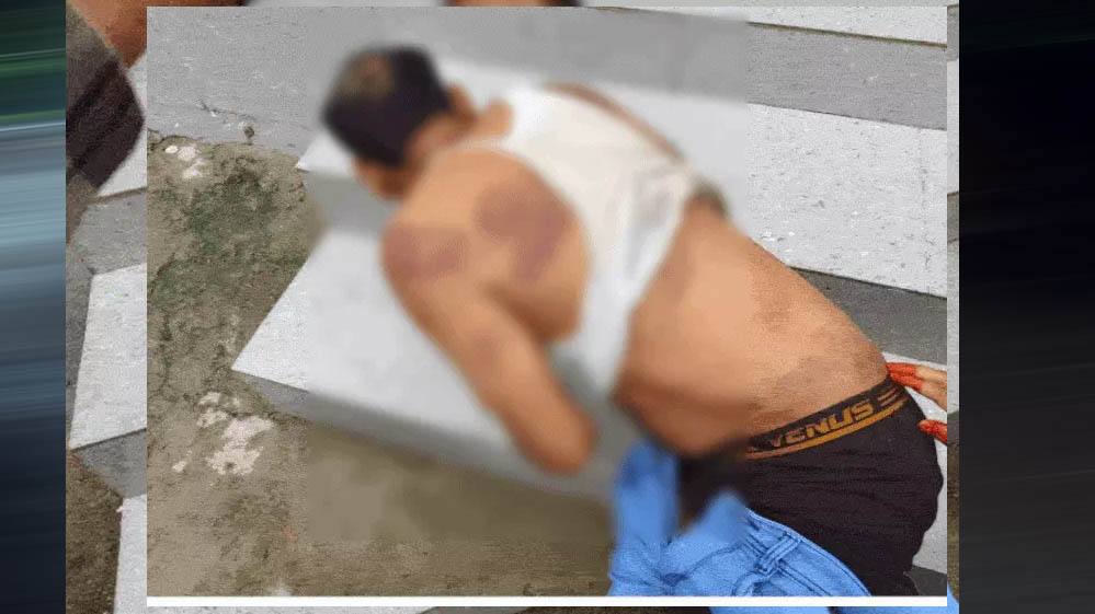भिंड में सहायक सचिव का अपहरण, 13 घंटे बंधक बनाकर बेरहमी से पीटा; पिस्टल की नोक पर चेक और स्टांप पेपर पर कराए साइन भिंड में सहायक सचिव का अपहरण, 13 घंटे बंधक बनाकर बेरहमी से पीटा; पिस्टल की नोक पर चेक और स्टांप पेपर पर कराए साइन