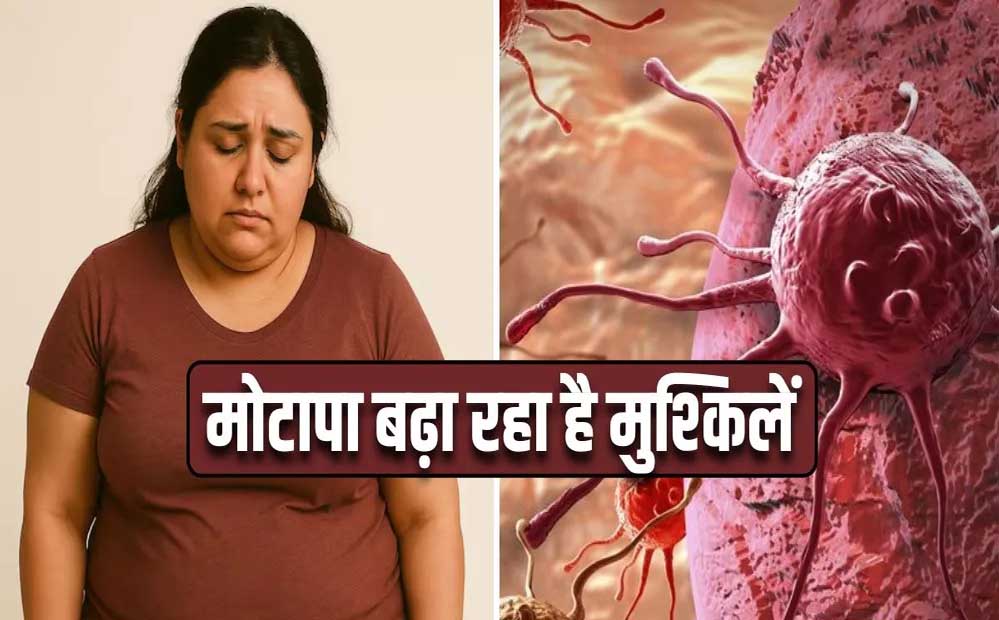 मोटापा-तनाव बढ़ा रहे कैंसर का खतरा! पुरुषों में ओरल तो महिलाओं में ब्रेस्ट कैंसर के मामले बढ़े