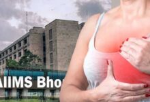 चौथे स्टेज के स्तन कैंसर में भी इलाज की उम्मीद, बीमारी की पहचान के आधार पर तय होगा उपचार