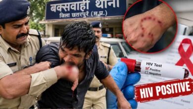 छतरपुर में रेप के आरोपी ने कांस्टेबल को काटा, मेडिकल जांच में HIV पॉजिटिव
