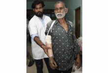 ट्रेन हादसे के दर्द पर ‘सेवा संकल्प’ का मरहम, धमतरी के तेजराम को दो घंटे में मिला कृत्रिम हाथ, लौटी जिंदगी की रंगत