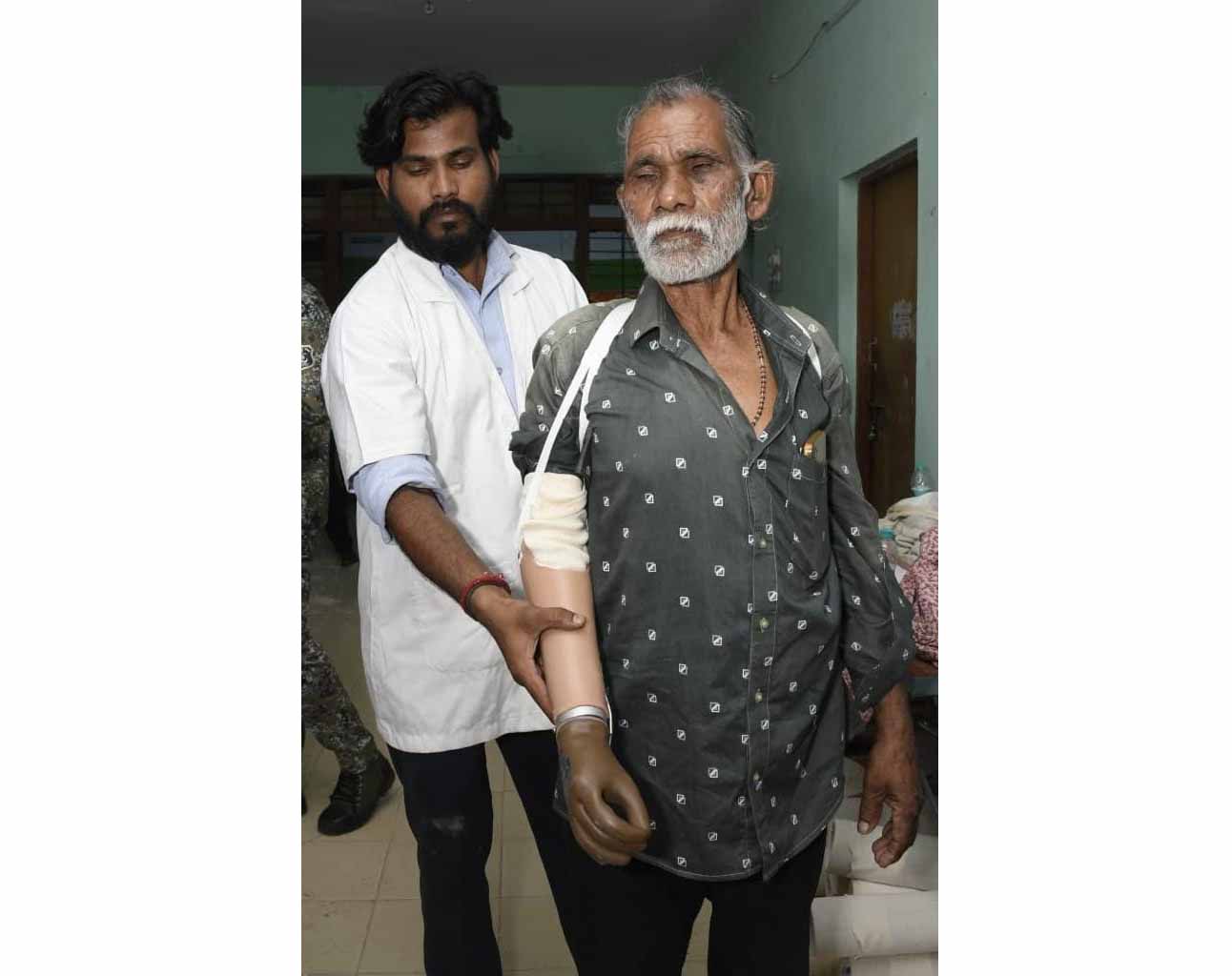 ट्रेन हादसे के दर्द पर ‘सेवा संकल्प’ का मरहम, धमतरी के तेजराम को दो घंटे में मिला कृत्रिम हाथ, लौटी जिंदगी की रंगत ट्रेन हादसे के दर्द पर ‘सेवा संकल्प’ का मरहम, धमतरी के तेजराम को दो घंटे में मिला कृत्रिम हाथ, लौटी जिंदगी की रंगत
